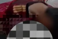 Korban malpraktik khitan. (Istimewa)