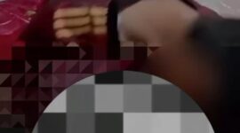 Korban malpraktik khitan. (Istimewa)