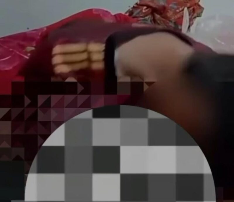 Korban malpraktik khitan. (Istimewa)