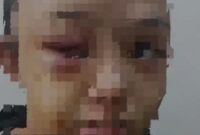 Kondisi korban penganiayaan oleh tantenya sendiri. (Tangkapan layar warga sekitar/istimewa)