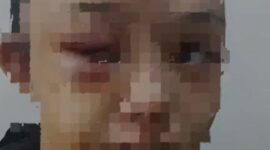 Kondisi korban penganiayaan oleh tantenya sendiri. (Tangkapan layar warga sekitar/istimewa)