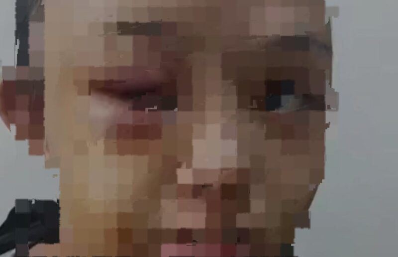 Kondisi korban penganiayaan oleh tantenya sendiri. (Tangkapan layar warga sekitar/istimewa)