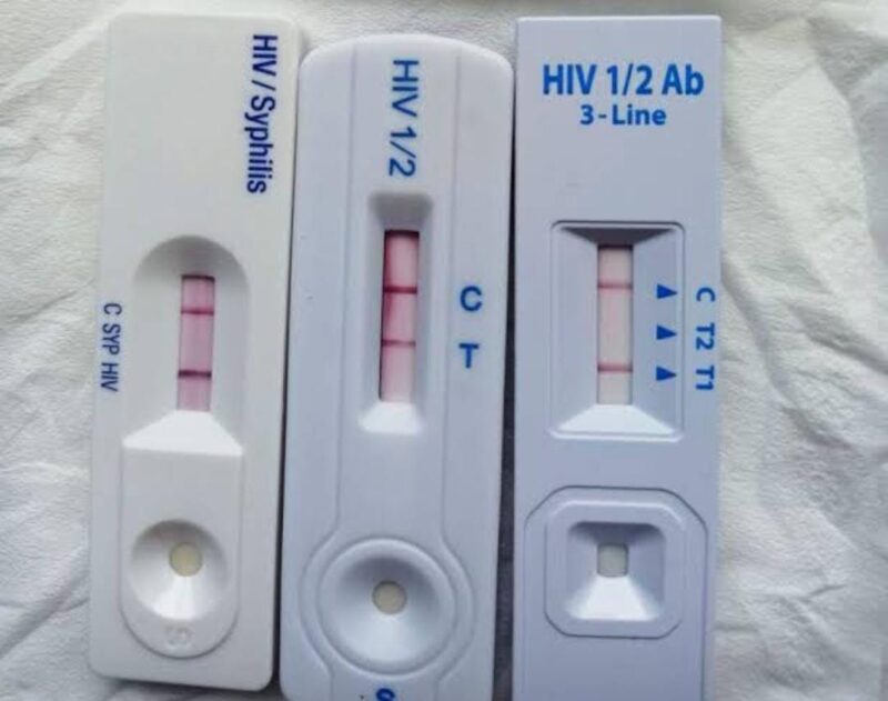 Hasil tes menunjukkan postif HIV. (Ilustrasi/Istimewa)